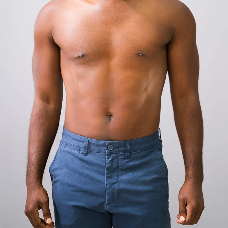 Αποτρίχωση Laser Κοιλιά (Άνδρες)